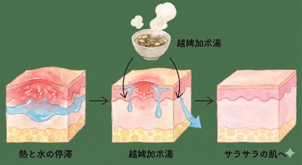 漢方の力で、皮膚の赤みと水分が引いていき、サラサラの肌に戻っていくイメージ図