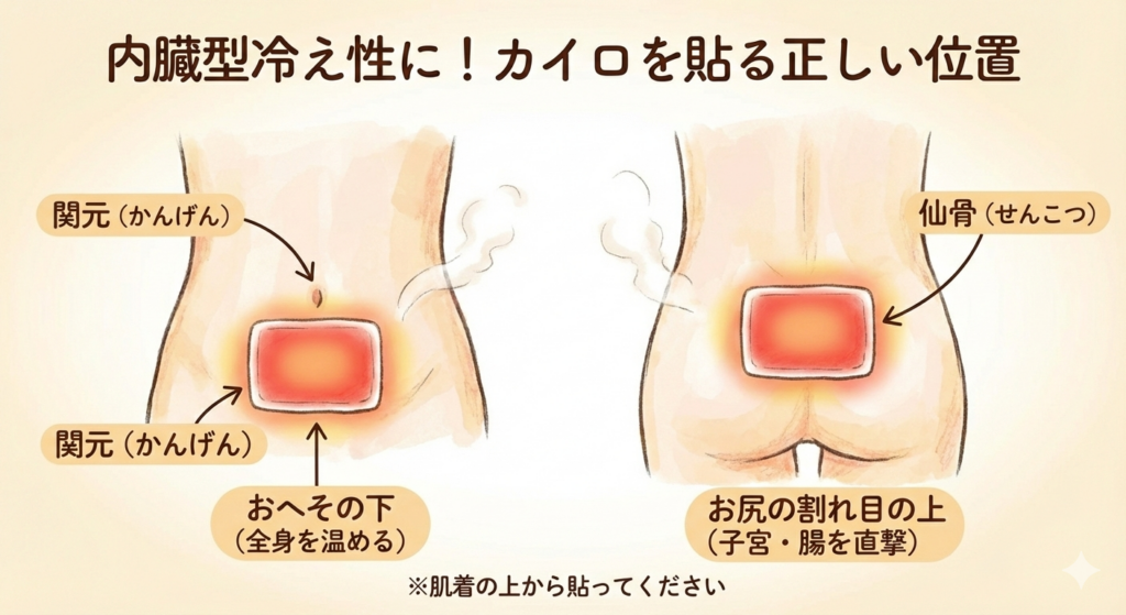 内臓型冷え性に効果的なカイロを貼る正しい位置の図解イラスト。お腹側はおへその下のツボ「関元(かんげん)」、背中側はお尻の割れ目の上の「仙骨(せんこつ)」にカイロを貼る場所を示している。肌着の上から貼るよう注意書きあり。